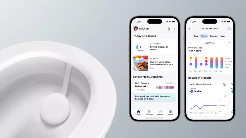 U-Scan de Withings
